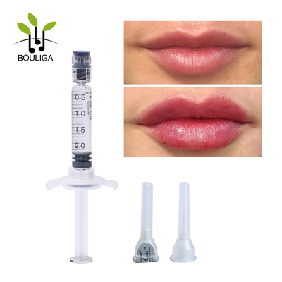 OdM Injectable Hyaluronic Acid Dermal Filler 2ml สำหรับการเสริมริมฝีปาก