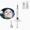 Korean Lip 1ml Hyaluronic Acid Dermal Filler สำหรับ Marionette Lines